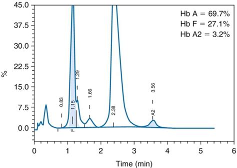 hemoglobinopathy fractionation profile without solubility